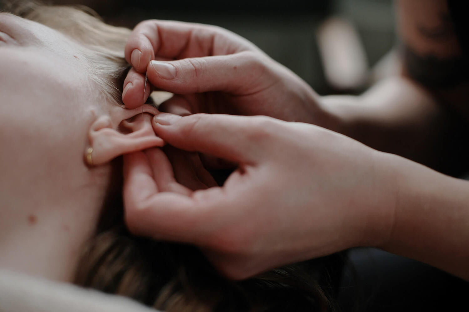 Øreakupunktur udført professionelt og med stor ekspertise